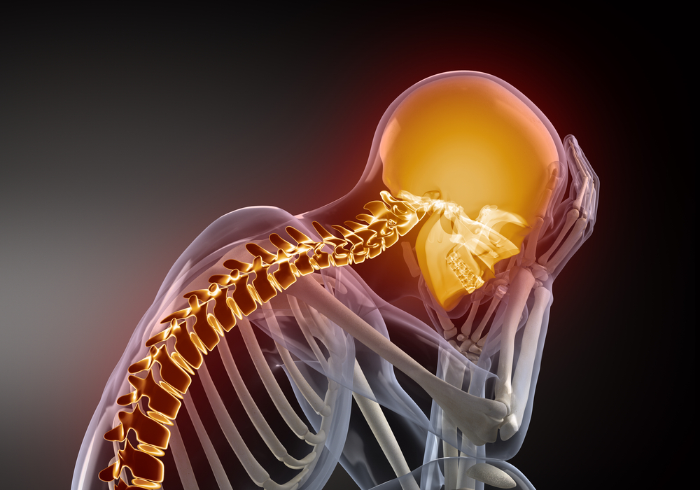 Skeleton with back pain from a case with a New York Workers' Compensation lawyer 3